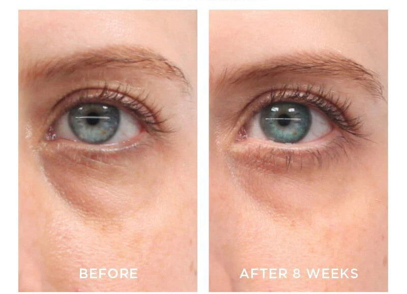 PURE RETINOL VITAMIN A 2.5% + HYALURONIC ACID HA - RETINOL WRINKLE CREAM / SERUM