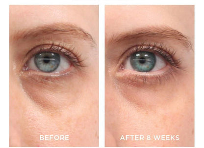 PURE RETINOL VITAMIN A 2.5% + HYALURONIC ACID HA - RETINOL WRINKLE CREAM / SERUM