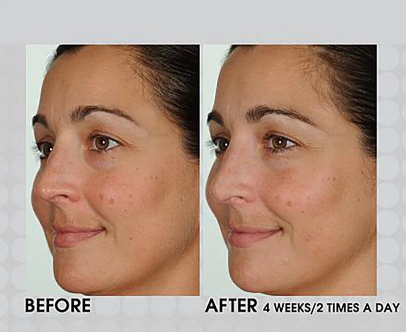 PURE RETINOL VITAMIN A 2.5% + HYALURONIC ACID HA - RETINOL WRINKLE CREAM / SERUM