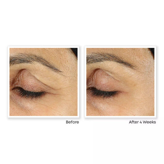 PURE RETINOL VITAMIN A 2.5% + HYALURONIC ACID HA - RETINOL WRINKLE CREAM / SERUM